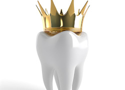 qu-est-ce-qu-une-couronne-dentaire-dentiste-paris-19
